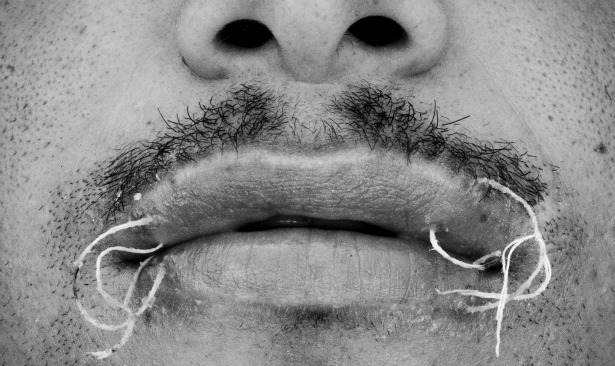 Lips Sewn Shut Pic Lipstutorial